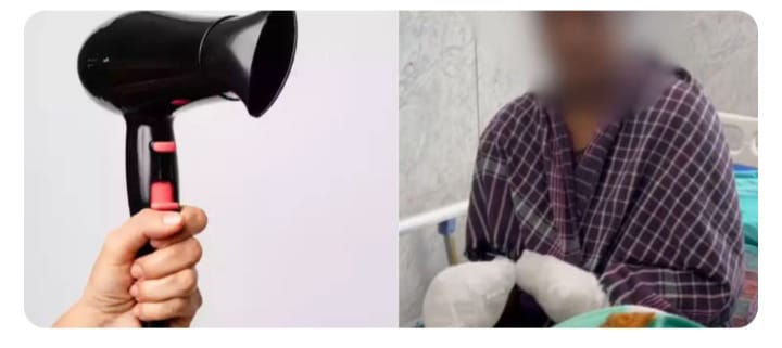 ഓൺ ലൈൻ വഴി വാങ്ങിയ ഹെയർ ഡ്രൈയർ പൊട്ടിത്തെറിച്ചു;യുവതിയുടെ ഇരു കൈപ്പത്തികളും നഷ്ടപ്പെട്ടു