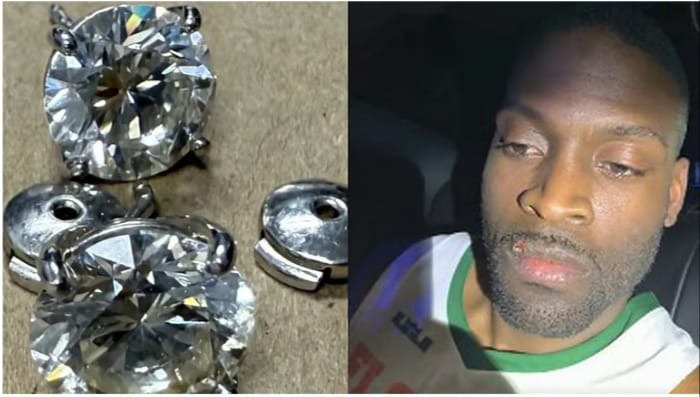 വിഴുങ്ങിയത് ആറ് കോടിയുടെ കമ്മൽ: തെളിവ് ‘അകത്ത്’ ; പുറത്ത് കവലായി പോലീസും ; കത്തിരിപ്പിനൊടുവിൽ….