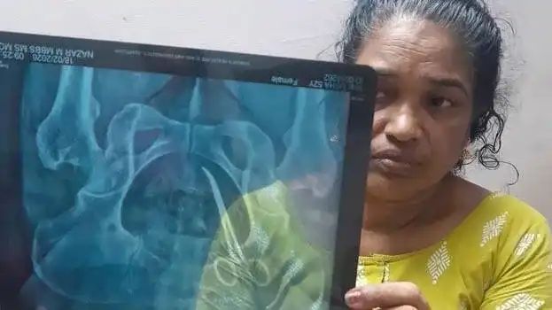 വണ്ടാനം മെഡിക്കല്‍ കോളേജിലെ ശസ്ത്രക്രിയാ പിഴവ് : ഡോക്ടര്‍ ജെ ഷാഹിദയെയും നഴ്സിനെയും സസ്പെൻഡ് ചെയ്തു