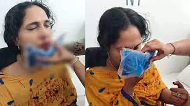 ക്ലാസില്‍ ഗെയിം കളിക്കുന്നത് തടഞ്ഞു; മലയാളി അധ്യാപികയെ ക്രൂരമായി മര്‍ദിച്ച്‌ എട്ടാം ക്ലാസ് വിദ്യാര്‍ഥി